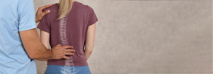 Chiropractic Orlando FL Scoliosis Person with scoliosis.